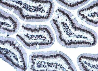 Immunohistochemistry-Paraffin: Histone H3 [Trimethyl Lys27] Antibody [NBP2-16840]